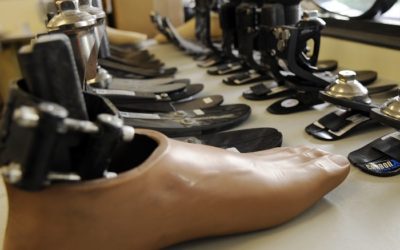 It’s Time To Stop Treating Limb Loss